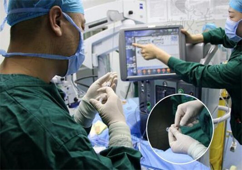 人工玻璃体球囊植入术的优点