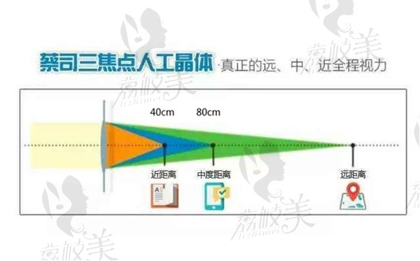 蔡司人工晶体型号有哪些