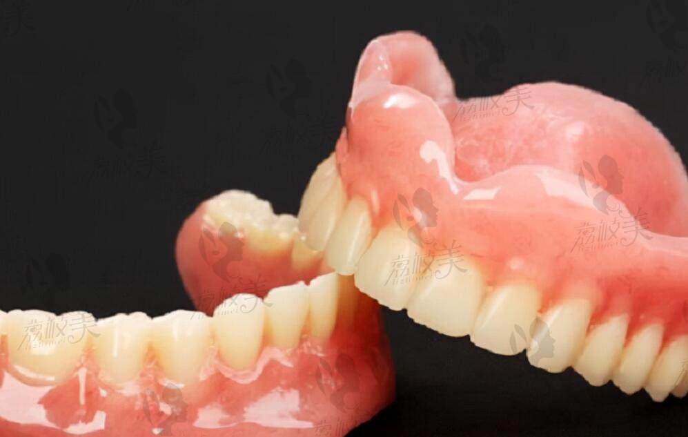 活动义齿和吸附性义齿的区别是什么