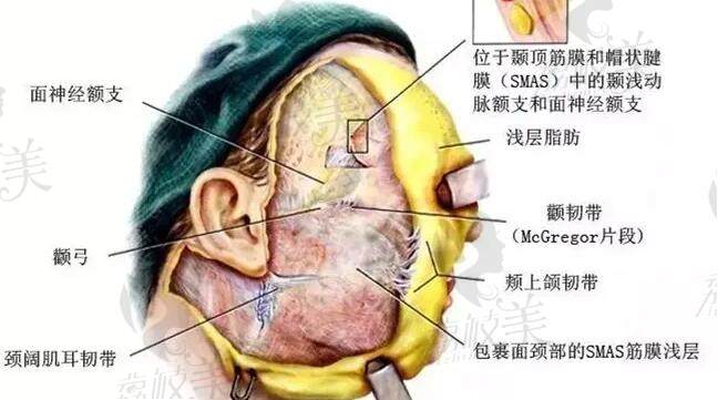 微拉美4.0提升多少钱