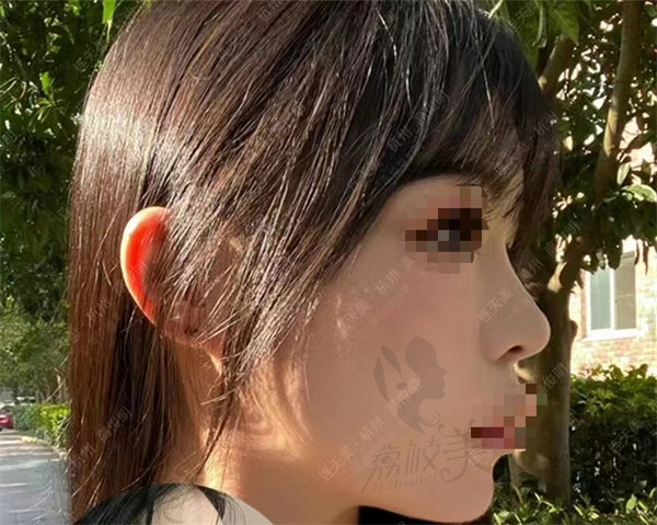杭州高俊明轮廓案 例