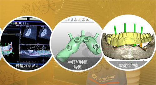 广州德伦口腔体育西店3D打印设计