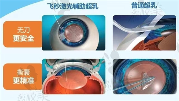 南宁普瑞眼科医院做近视手术价格收费 南宁普瑞眼科医院做近视手术价格收费