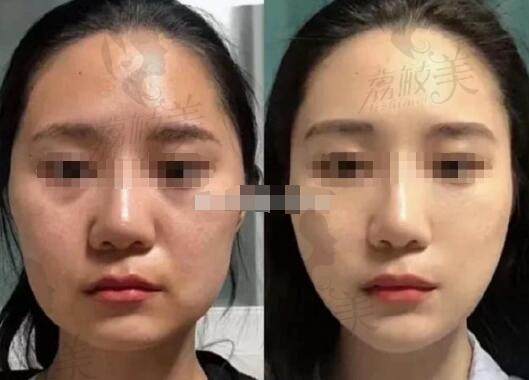 北京加减美医疗美容面部提升顾客