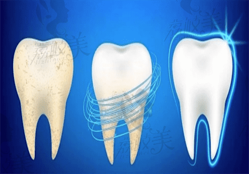 南京牙齿美白图