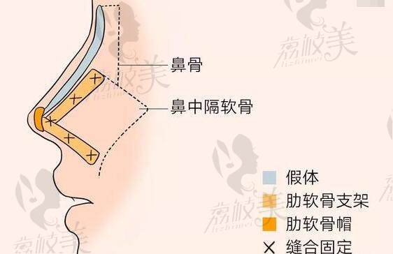 上海联合丽格整形医院价格表 上海联合丽格整形医院价格表