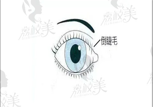 西京医院眼科哪个大夫好