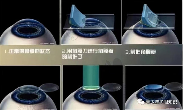 眼睛造成过度的疲劳 眼睛造成过度的疲劳