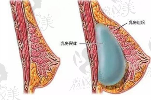 上海华美整形医院什么项目比较好