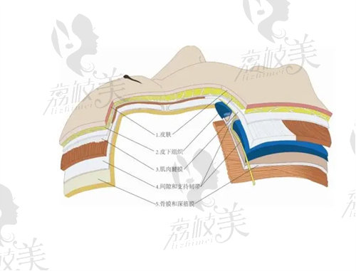 上海倪峰医生拉皮怎样