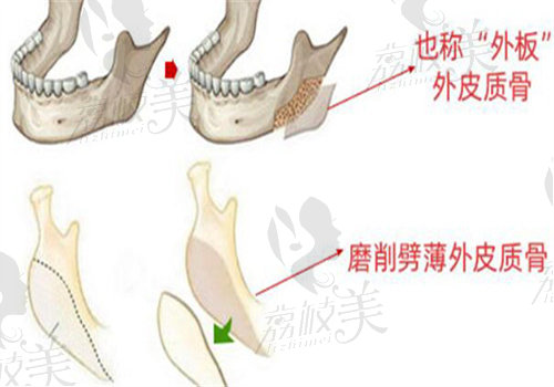 下颌角和长曲线下颌角的区别