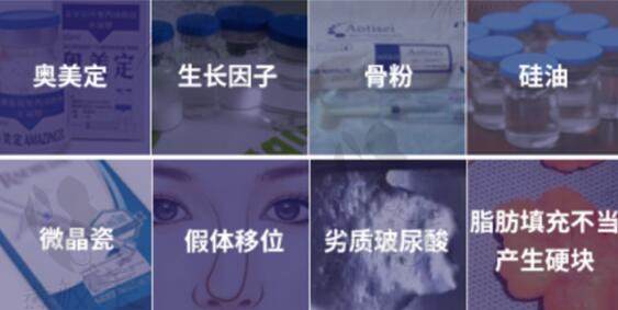 北京煤医整形的周云超做的内窥镜奥美定取出很干净