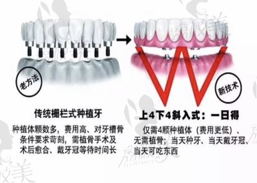 苏大附一医院口腔科预约方式一览