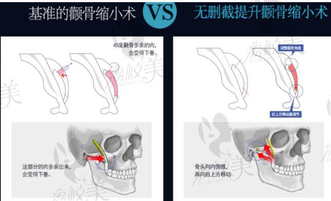 韩国faceline整形医院怎么样