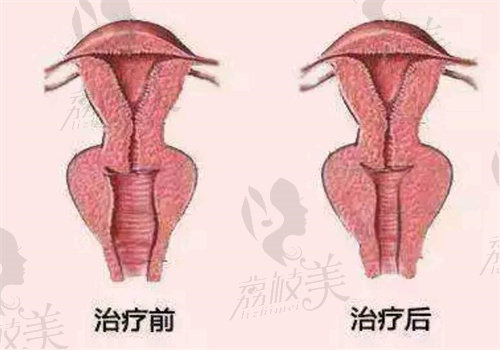 韩国女性私密整形医院排名