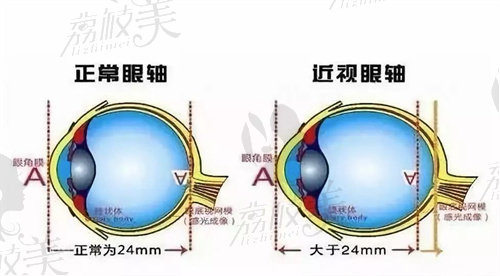 成都何氏视佳眼科医院怎么样