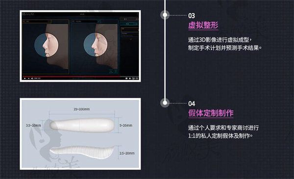 韩国gng做鼻子价格表