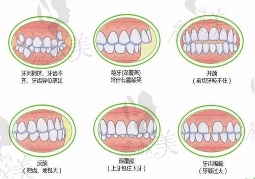 eta和mrc矫正器的区别