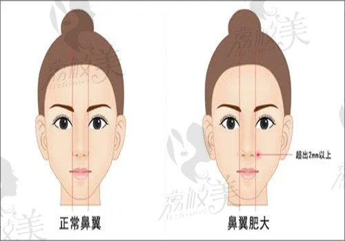 深圳军科整形医院4D打印隆鼻技术特点