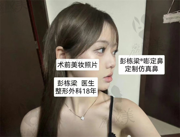 广州彭栋梁做鼻子怎么样