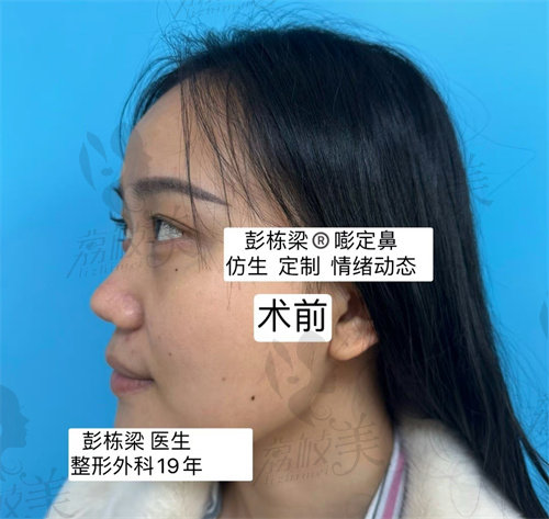 广州海峡整形美容医院做鼻子好吗