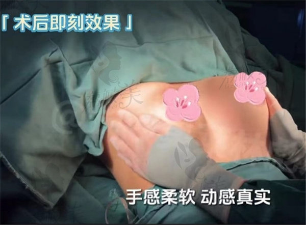 长沙美莱林飙斌隆胸<span style= 长沙美莱林飙斌隆胸<span style=