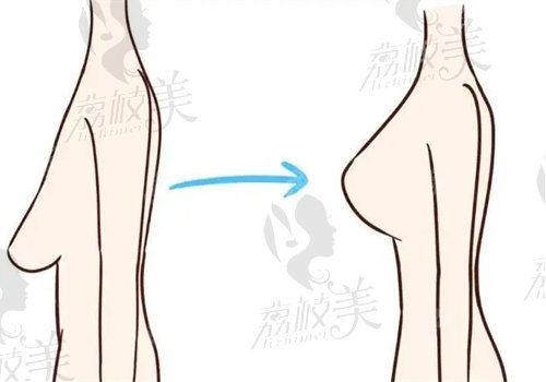 傲诺拉和曼托的区别