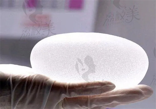 傲诺拉和曼托哪种更好
