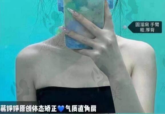 杭州浮想国整形医院坐诊的蒋铮铮口碑好