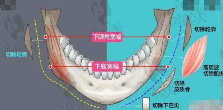 成都友谊整形医院怎么样