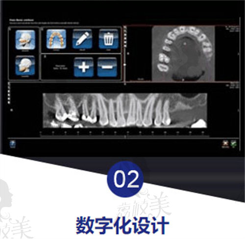 廣州穗華口腔醫(yī)院數(shù)字化設(shè)計(jì)