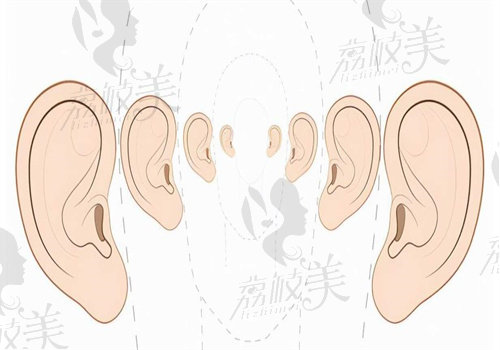 安波耳再造收費(fèi)不貴