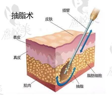 北京东方和谐整形医院怎么样