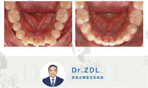 張棟梁正畸怎么掛號(hào)