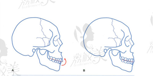 北京張棟梁骨性正畸醫(yī)院地址