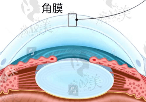 合肥普瑞眼科医院刘红山手术图