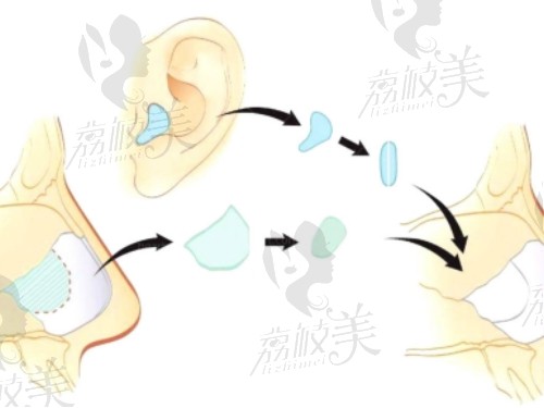 鄭州中醫(yī)院趙絳波做耳朵手術(shù)好嗎？