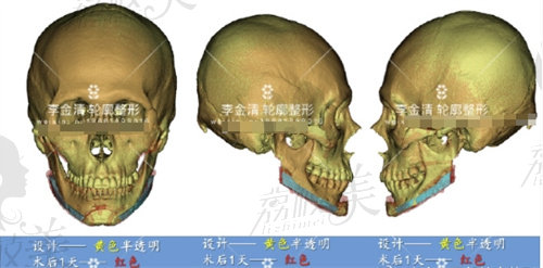 西安李金清