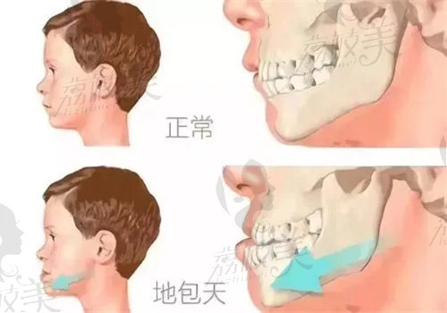 正畸醫(yī)生侯旭怎么樣