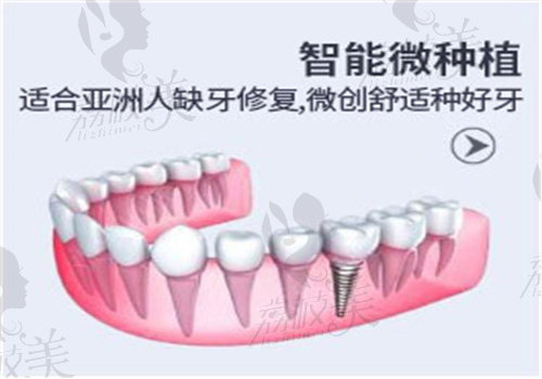 深圳穗华口腔医院种植牙怎么样