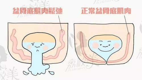 国内3d生物束带术紧缩医院前十