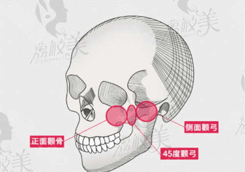 重庆松山医院做面部轮廓手术