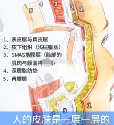 祝东升做面部提升怎么样