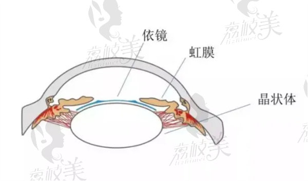 prl悬浮镜手术要多少钱