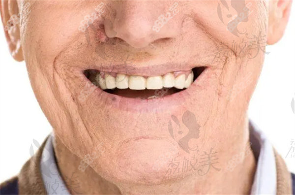 六十岁老人种牙好还是镶牙好