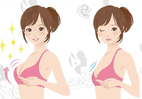 北京丽都医疗美容医院隆胸图
