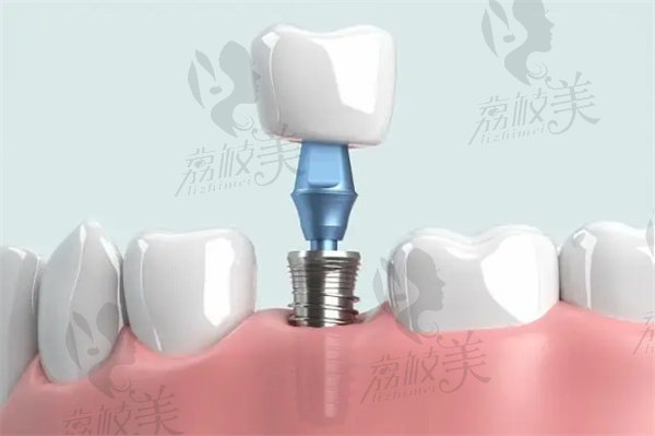 北京海淀十大种植牙口腔医院排名前十名单2024版