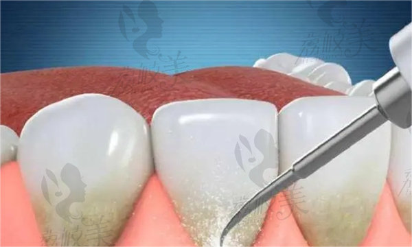 北京海淀十大种植牙口腔医院排名前十名单2024版