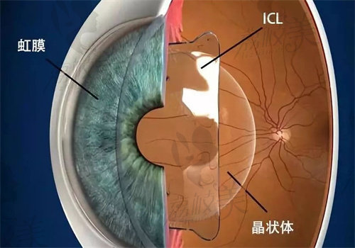 刘晓萍眼科医生简介