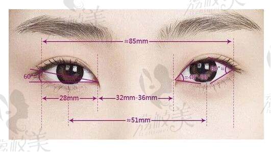 荷鲁斯清甜眼技术是高亮主 任研发的一种保留上眼睑主干血管法双眼皮手术